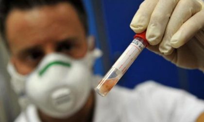 Casi di tubercolosi a Carugate, cinquanta persone in profilassi
