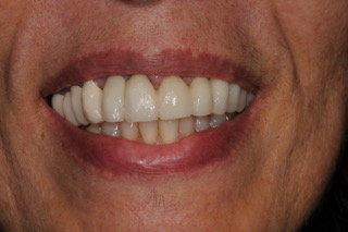 Odontoiatria del sorriso