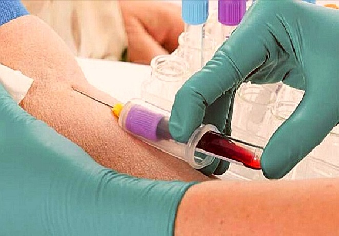 Venerdì 16 agosto sarà chiuso il centro prelievi di Vaprio