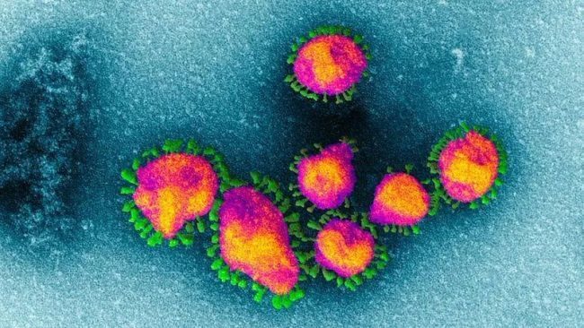 Coronavirus: operativi 3 laboratori e 17 reparti malattie infettive. C’è anche il San Raffaele