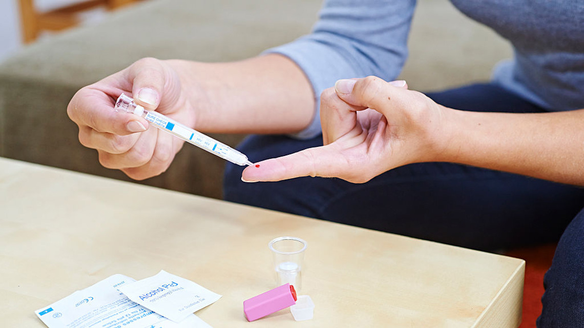 Test gratuiti HIV e HCV al San Raffaele e a Cernusco