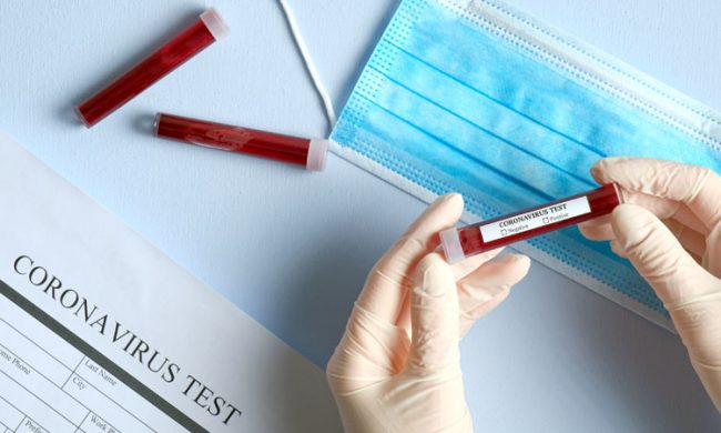 Test sierologici gratuiti per capire se si è positivi al Covid