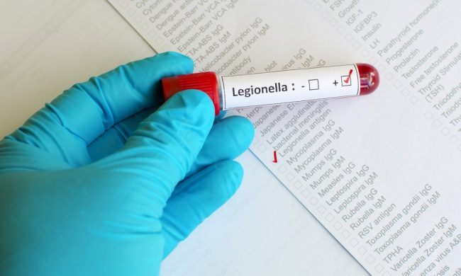 Il comunicato di Comune e Asst Melegnano: nessun rischio legionella