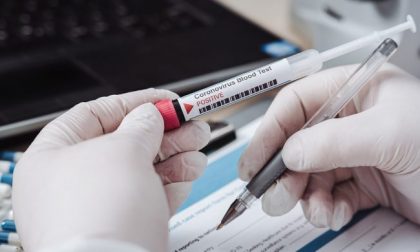 Regione Lombardia: ok test sierologici privati in screening collettivi non a carico SSR