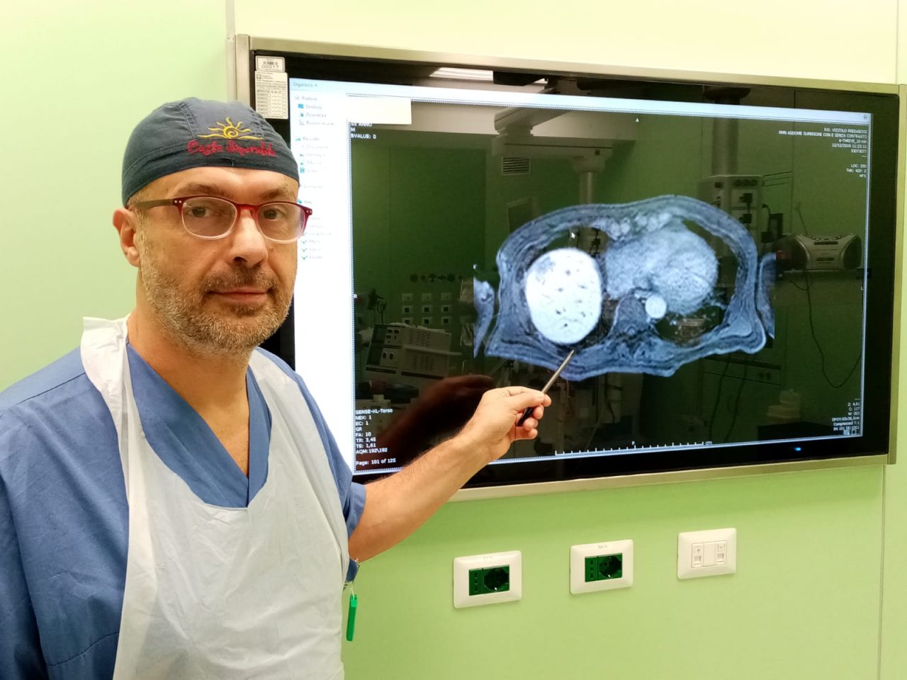 Cancro al colon con metastasi al fegato, intervento quasi miracoloso a Vizzolo Predabissi