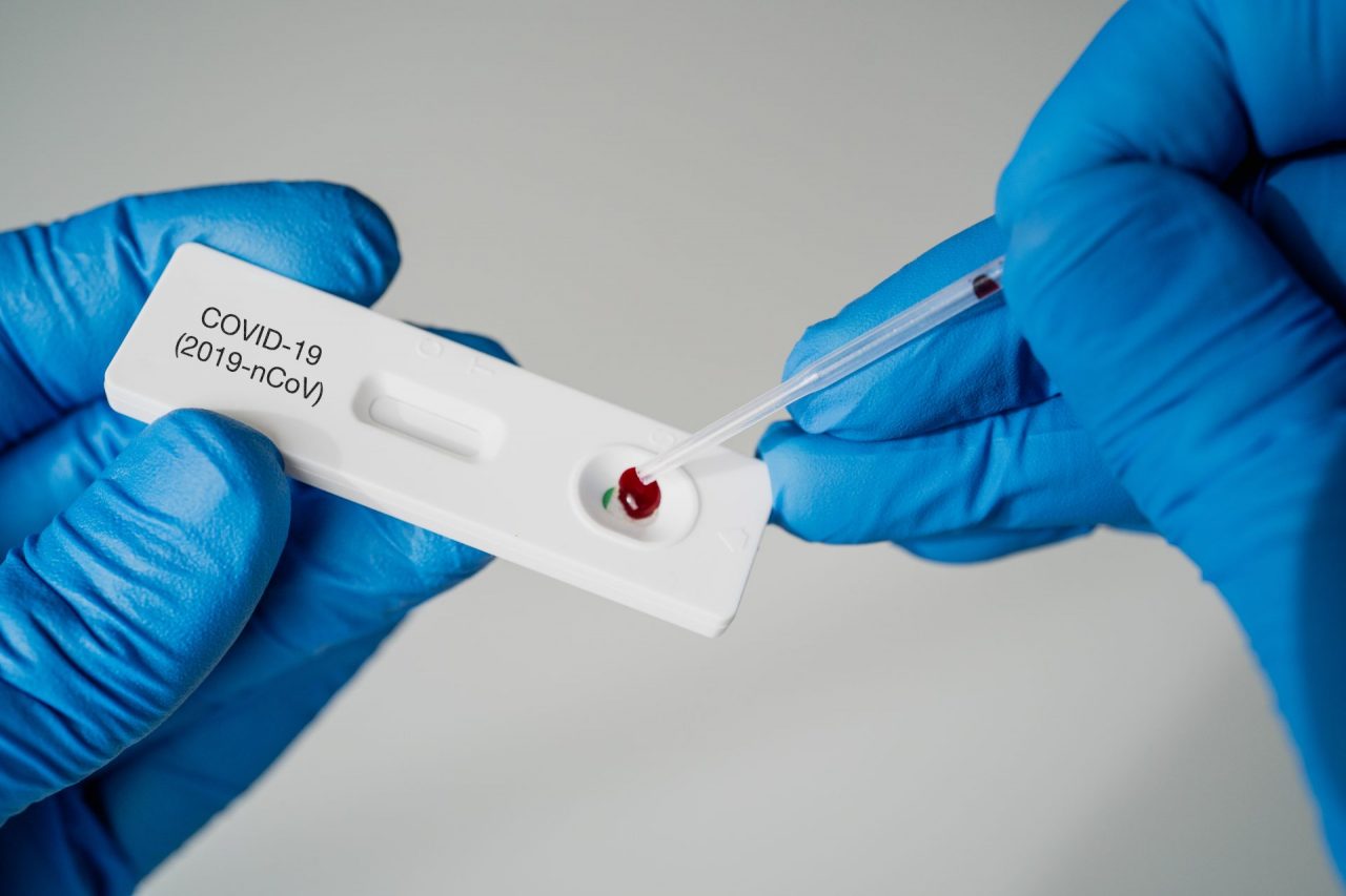Tamponi e screening per tutti i dipendenti dell’Asst Melegnano e Martesana