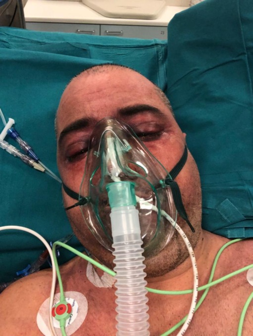 Rischiò la vita schiacciato da un bancale. Rimasto invalido, l’operaio di Trezzo ora è senza lavoro