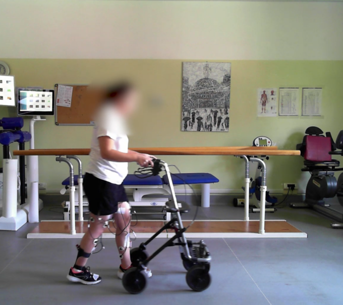 Dopo una lesione spinale torna a camminare: l’incredibile risultato del San Raffaele