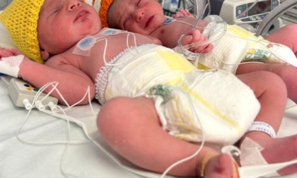 Doppio parto gemellare in Martesana: due maschi e due femminucce