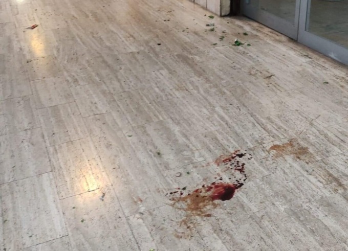 Rissa a Cologno in piena notte, l’ennesima. Ventenne in ospedale