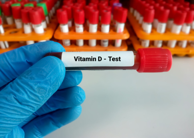 Ipovitaminosi D, campagna di prevenzione al via lunedì 3 marzo
