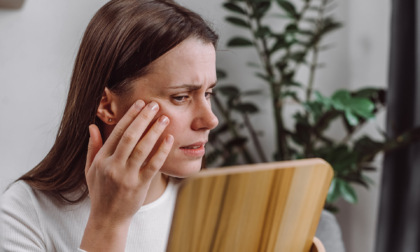 Dermatite da stress: come le emozioni influenzano la tua pelle e come intervenire