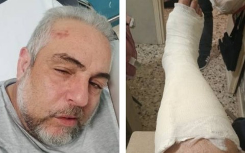 Preso a pugni davanti alla famiglia per una sigaretta negata: esagitato arrestato dai Carabinieri