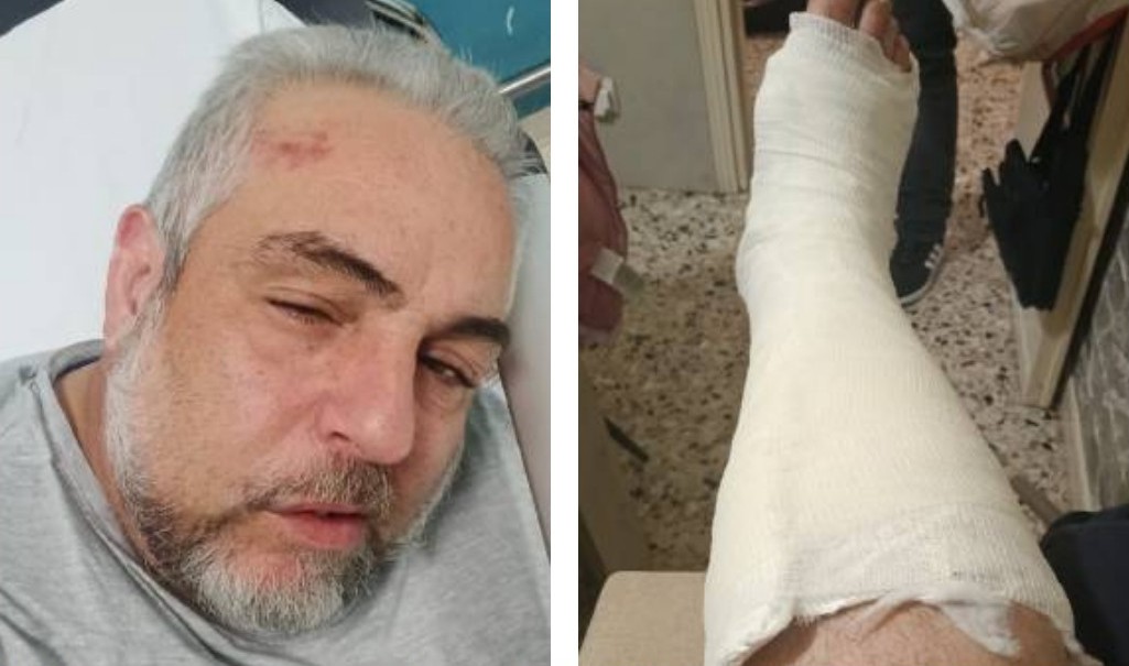 Preso a pugni davanti alla famiglia per una sigaretta negata: esagitato arrestato dai Carabinieri
