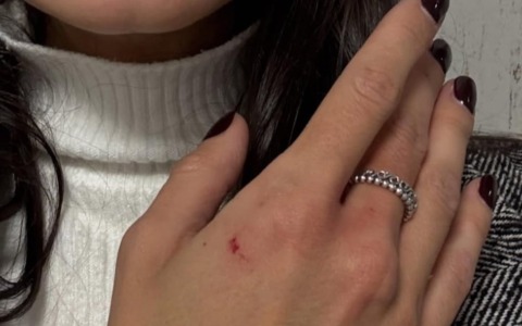 Aggredisce una ragazza sul treno senza motivo: verrà espulso