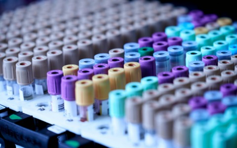 Check-up metabolico a novembre: la prevenzione firmata Glab