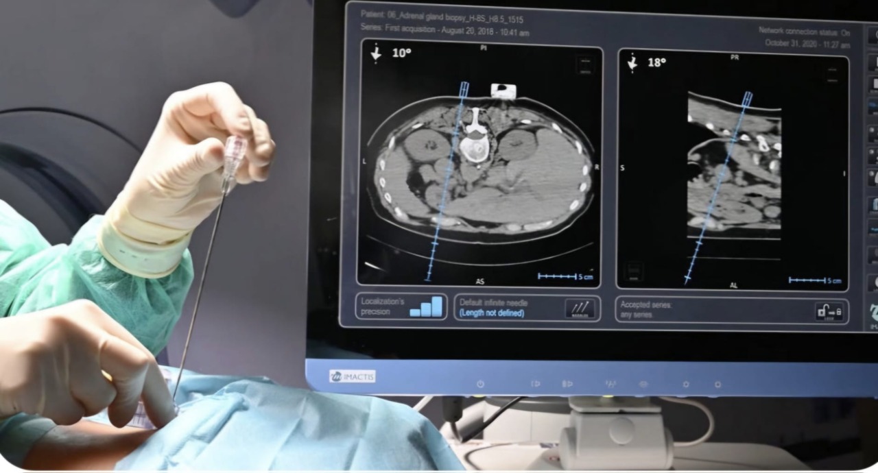 Interventi di estrema precisione: un nuovo capitolo per la Radiologia Interventistica dell’Asst Melegnano Martesana