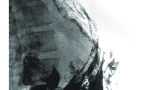 “Deep Landscape” in mostra al Museo MAiO: le radiografie dimenticate diventano arte e riflessione