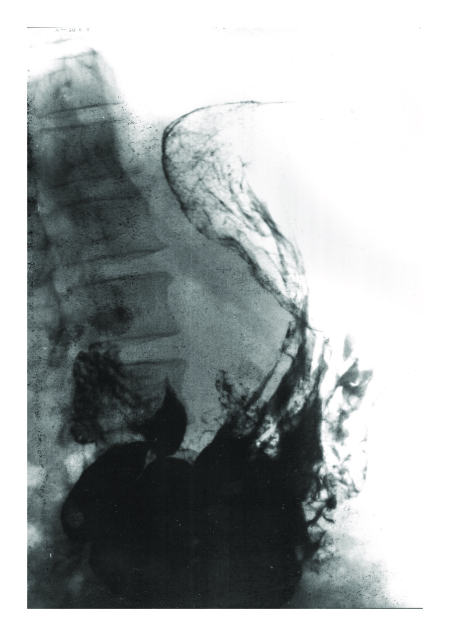 “Deep Landscape” in mostra al Museo MAiO: le radiografie dimenticate diventano arte e riflessione