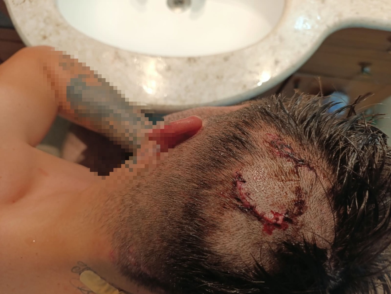Aggredito fuori da un bar dal branco e lasciato in una pozza di sangue