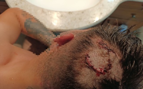 Aggredito fuori da un bar dal branco e lasciato in una pozza di sangue